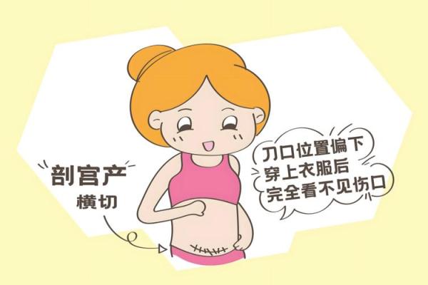 2025年7月剖腹产吉日权威发布